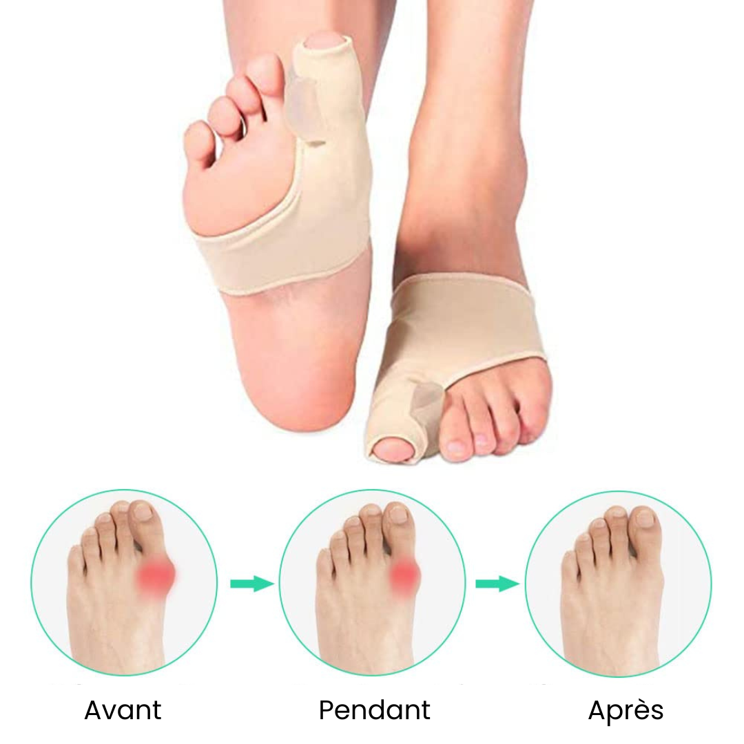 Orthèse pour hallux valgus TivaHome