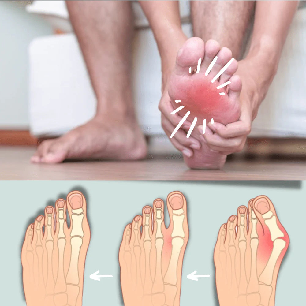Orthèse pour hallux valgus TivaHome